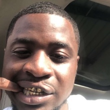Cleftlippbaby